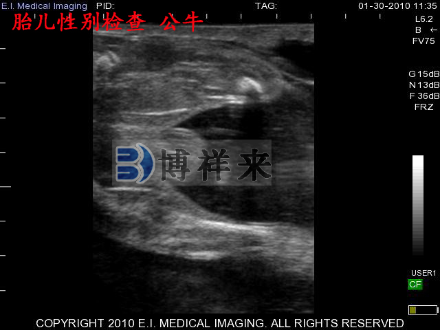 牛用B超，奶牛B超學(xué)習(xí)，奶牛懷孕60天B超影像學(xué)習(xí)