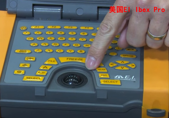 進(jìn)口獸用B超IBEX Pro/R主機(jī)鍵盤(pán)示意圖
